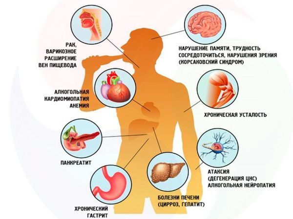 Почему не пьянеешь от алкоголя и какие от этого последствия?