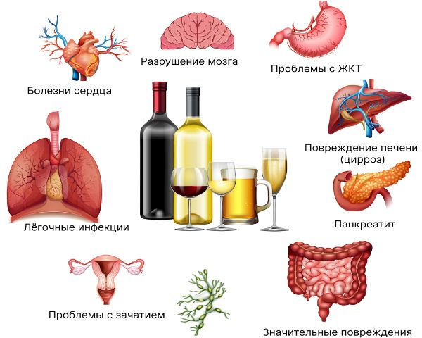 Сколько лет живут алкоголики?
