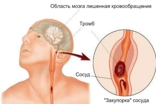 Боли после алкоголя. Какие бывают и от чего появляются?